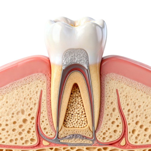 progressdental rootcanalservice (2)